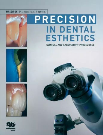 Precision in Dental Esthetics: Clinical and Laboratory Procedures - Domenico Massironi / Romeo Pasce