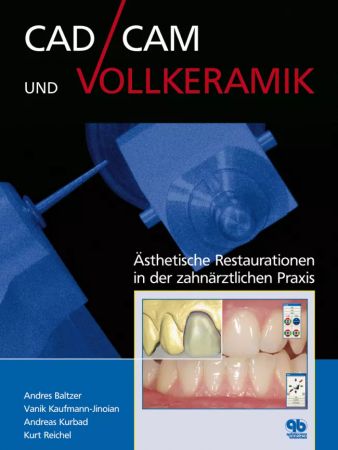 CAD/CAM und Vollkeramik - Andres Baltzer / Vanik Kaufmann / Andreas Kurbad / Kurt Reichel
