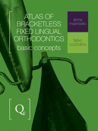 Atlas of Bracketless Fixed Lingual Orthodontics, Basic Concepts - Anna Mariniello / Fabio Cozzolino