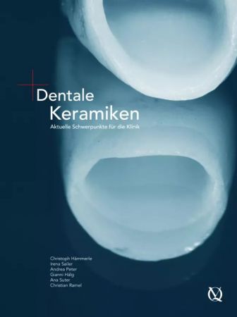 Dentale Keramiken - Christoph Hämmerle / Irena Sailer / Andrea Thoma / Gianni Hälg / Ana Suter / Chr