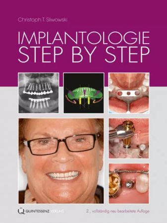 Implantologie Step by Step - Christoph T. Sliwowski