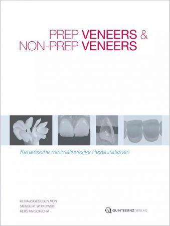 Prep Veneers und Non-Prep Veneers - Siegbert Witkowski / Kerstin Schicha (Hrsg.)