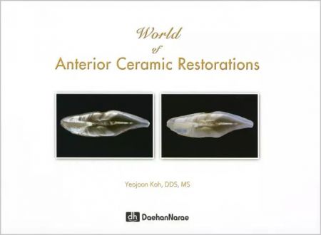 World of Anterior Ceramic Restorations - Yeojoon Koh