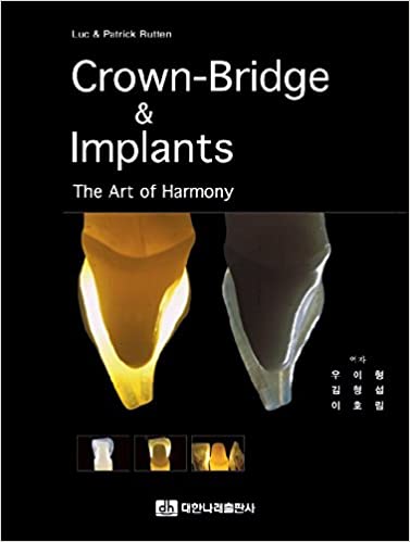 Crown - Bridge & Implants eng.