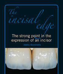 The Incisal Edge: The strong point in the expression of an incisor - Sommella
