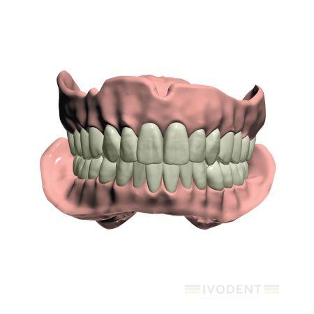 Full Denture Stand Alone license