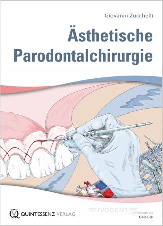 Aesthetische Parodontalchirugue,Zuccheli