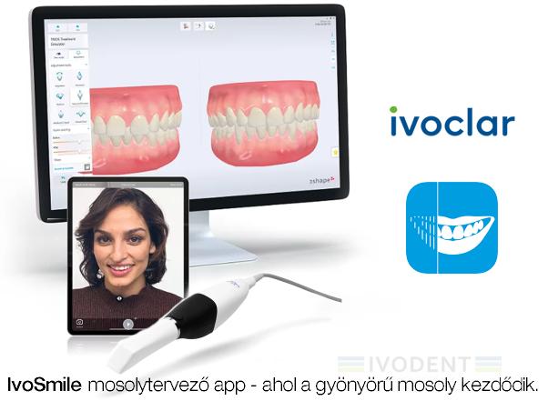 IvoSmile App előfizetés