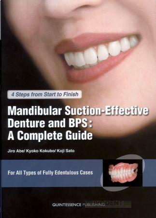 Mandibular Suction-Effective Denture and BPS: A Complete Guide