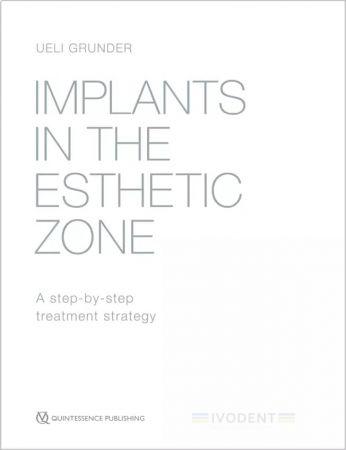 Implants in the Esthetic Zone - Leseprobe