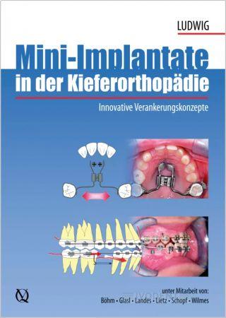 Mini-Implantate in der Kieferorthopädie - Björn Ludwig (Hrsg.)