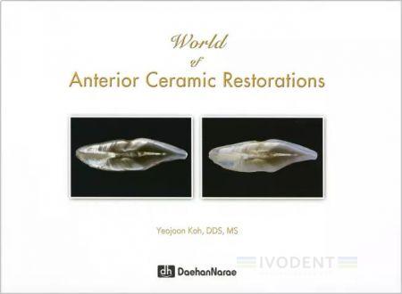 World of Anterior Ceramic Restorations - Yeojoon Koh