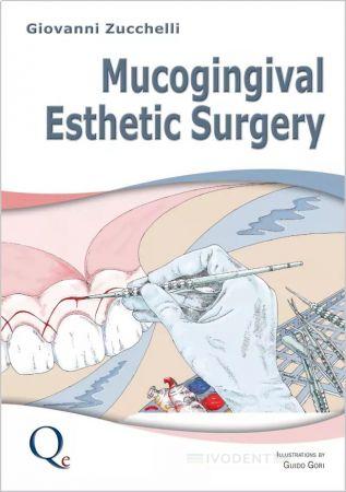 Mucogingival Esthetic Surgery - Giovanni Zucchelli