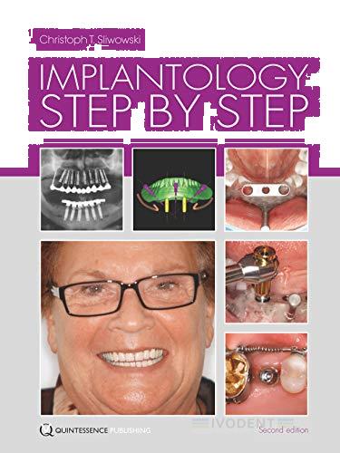 Implantologie Step by Step, Sliwowski ANGOL