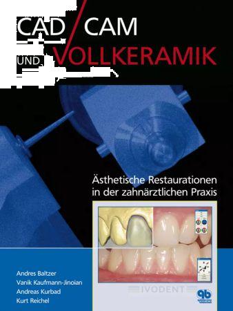 CAD/CAM und Vollkeramik - Andres Baltzer / Vanik Kaufmann / Andreas Kurbad / Kurt Reichel