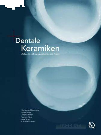 Dentale Keramiken - Christoph Hämmerle / Irena Sailer / Andrea Thoma / Gianni Hälg / Ana Suter / Chr