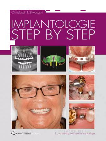 Implantologie Step by Step - Christoph T. Sliwowski