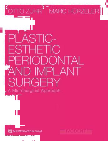 Plastic-Esthetic Periodontal and Implant Surgery - Otto Zuhr / Markus B. Hürzeler