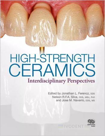 High-Strength Ceramics - Jonathan L. Ferencz / Nelson R. F. A. Silva / José M. Navarro (Hrsg.)