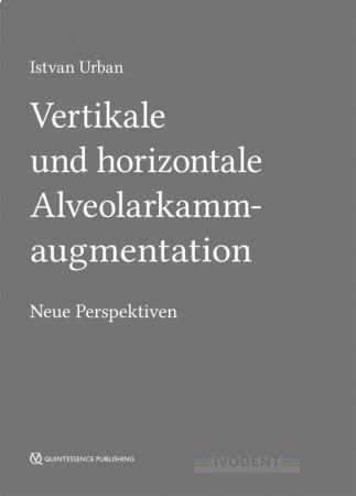 Vertikale und horizontale Alveolarkammaugmentation - Urbán István