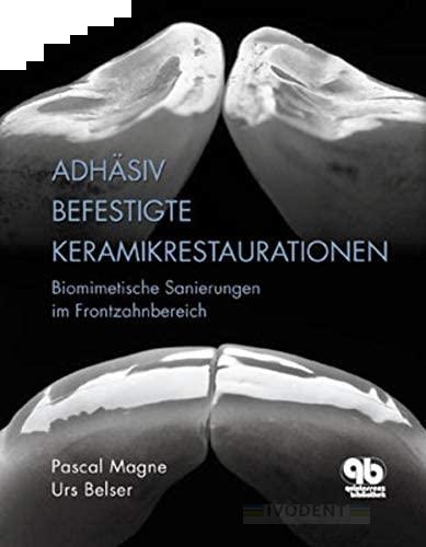 Adhäsiv befestigte Keramikrestaurationen (Magne, Pascal/Belser, Urs) 2004 GER